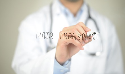 Getting Ready For Hair Transplant Surgery