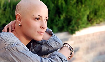 Chemotherapy Hair Loss