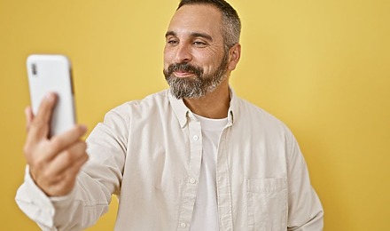Do Beard Transplants Look Natural