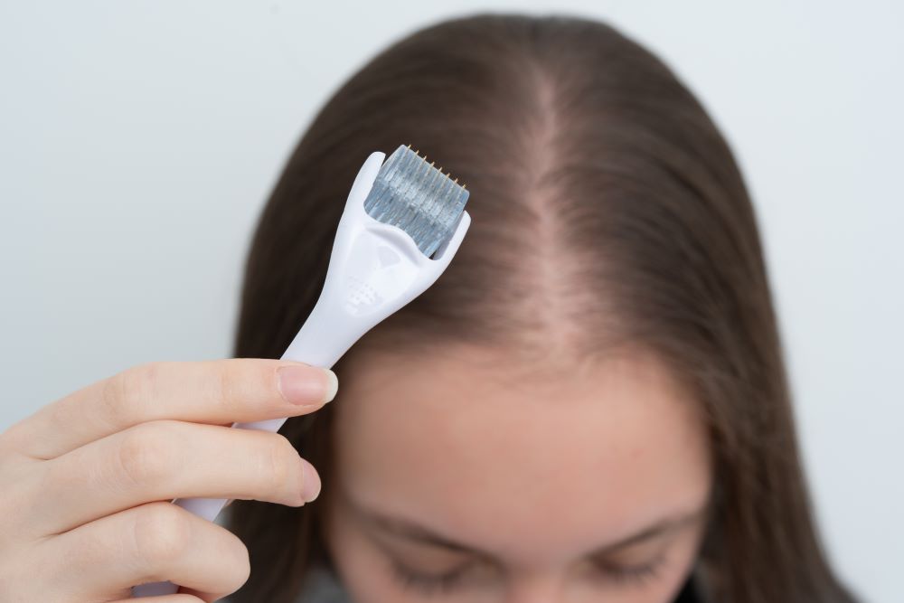 When can I use a derma roller after a hair transplant?