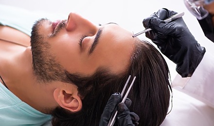 Hair Plugs Vs Hair Transplant