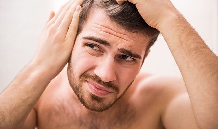 Uneven Hairline