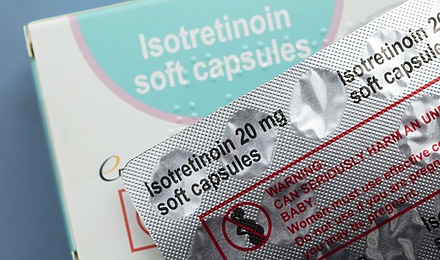 Accutane Hair Loss