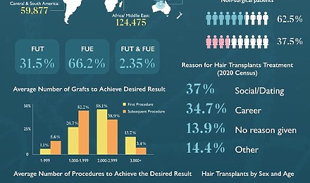 Hair Transplant Statistics 2025