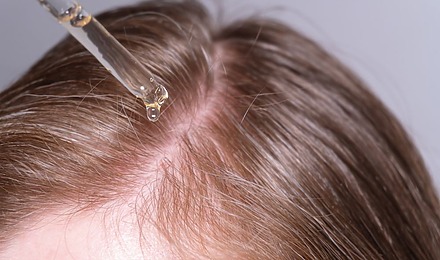 Stemoxydine For Hair Loss