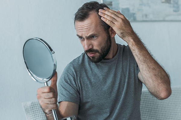 Hair Loss Symptoms
