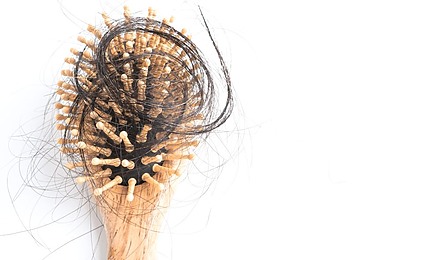 Losing Your Hair