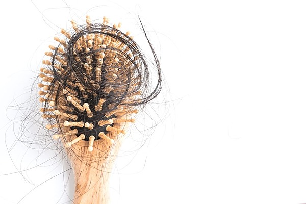 Losing Your Hair