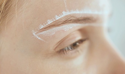 Eyebrow Hair Loss