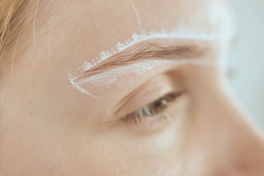 Eyebrow Hair Loss
