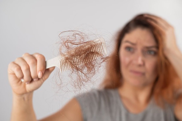 Telogen Effluvium Symptoms