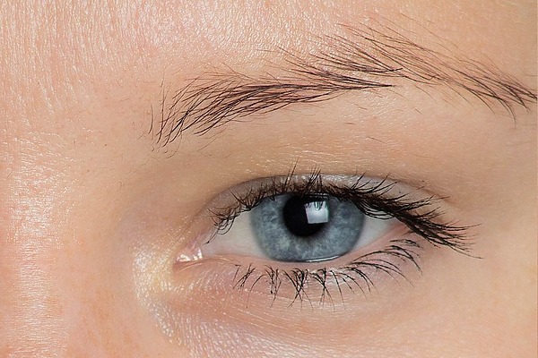 Does Minoxidil work eyebrows