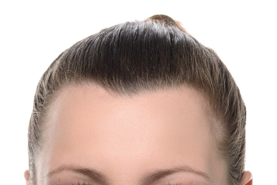 Widow's Peak
