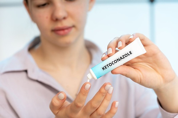 Ketoconazole And Hair Loss