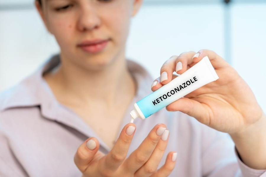 Ketoconazole And Hair Loss