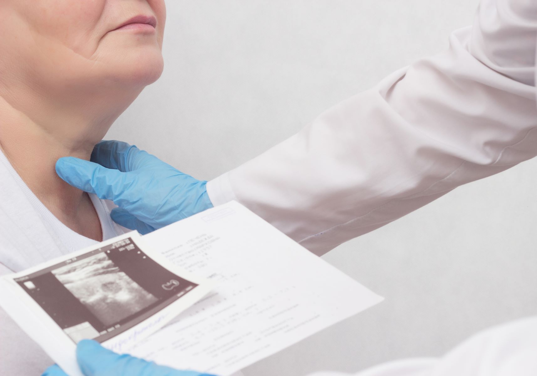 Hypothyroidism can cause hair loss