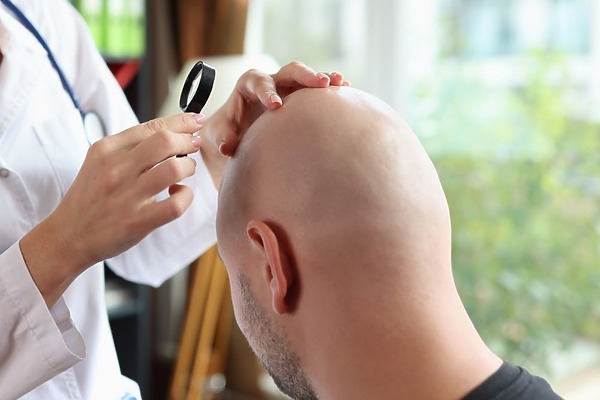 Scarring Alopecia