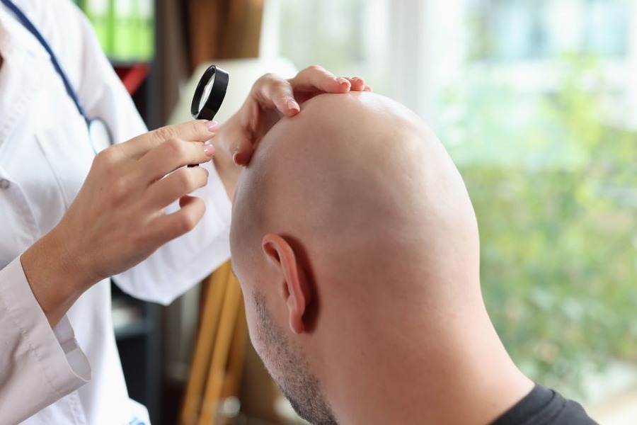 Scarring Alopecia