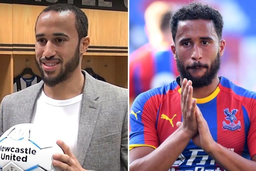 Andros Townsend Hair Transplant