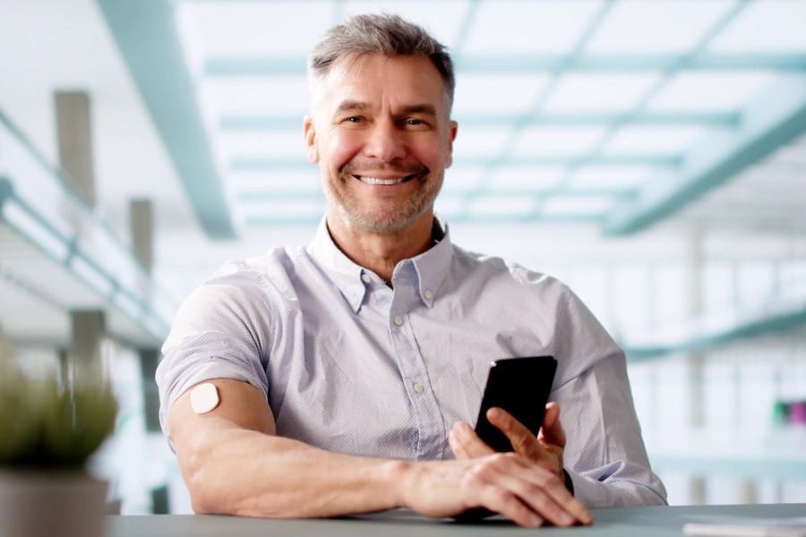 Diabetes Hair Loss