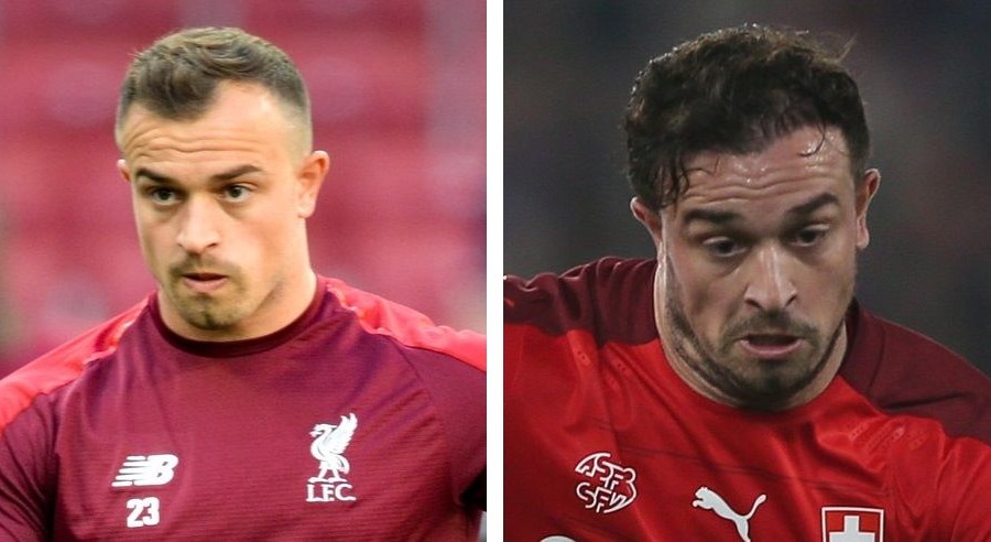 Xherdan Shaqiri Hair Transplant