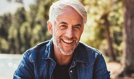 Hair Transplant After 10 Years
