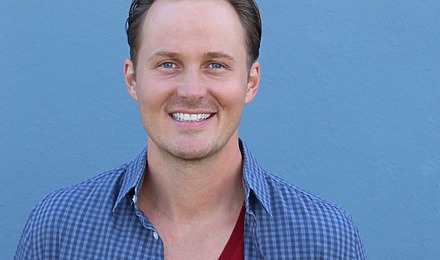 Receding Hairline Transplant Cost