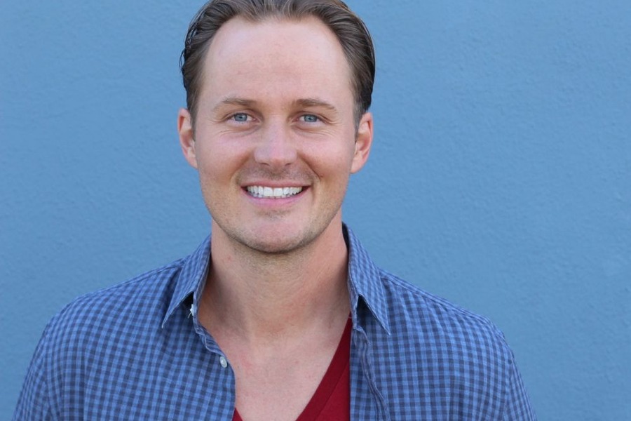Receding Hairline Transplant Cost