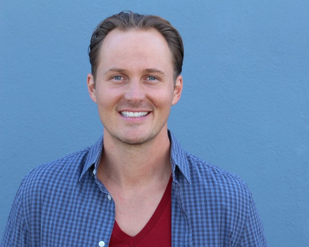 receding hairline transplant cost