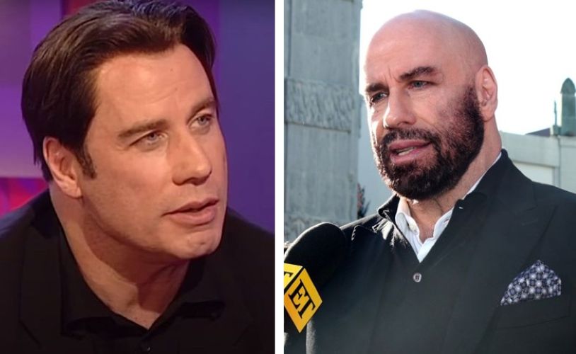 John Travolta with hair vs John Travolta bald