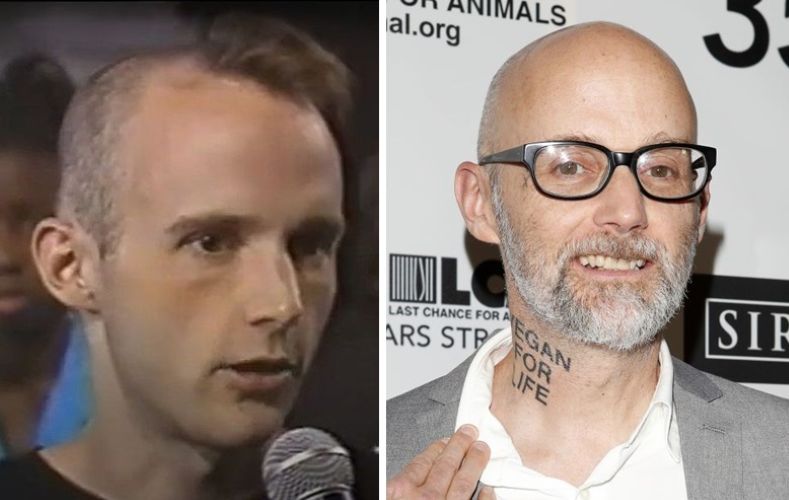 Moby wih hair vs Moby bald