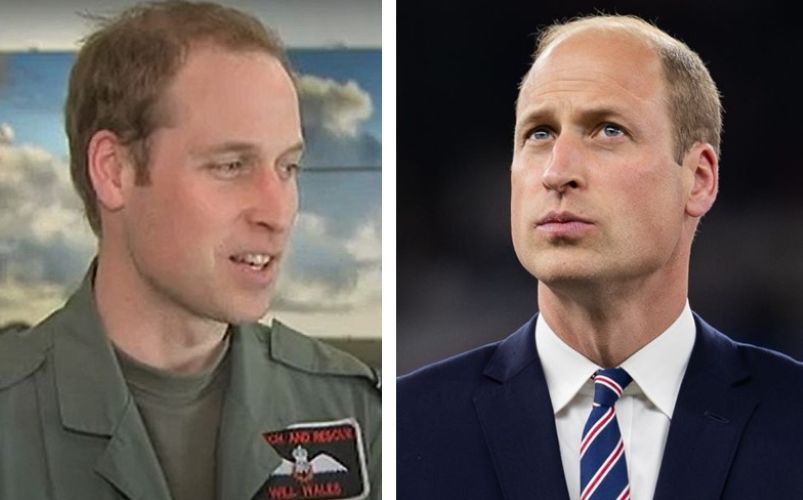 Prince William with hair vs Prince William bald