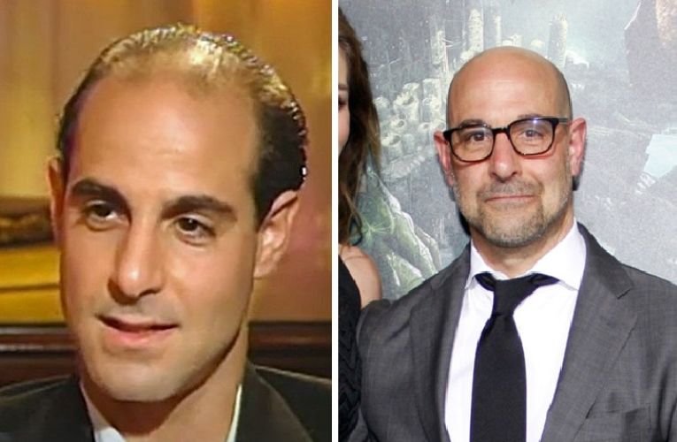 Stanley Tucci with hair vs Stanley Tucci bald