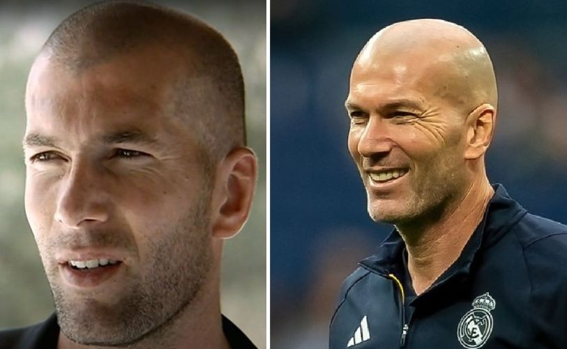 Zinedine Zidane with hair vs Zinedine Zidane bald