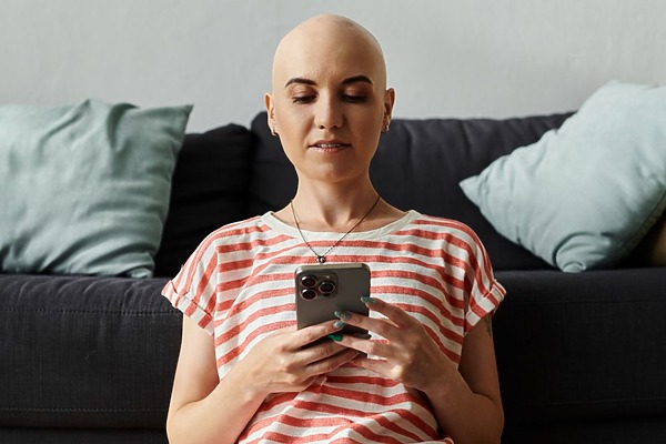 Can You Get Alopecia Areata Treatment On The NHS