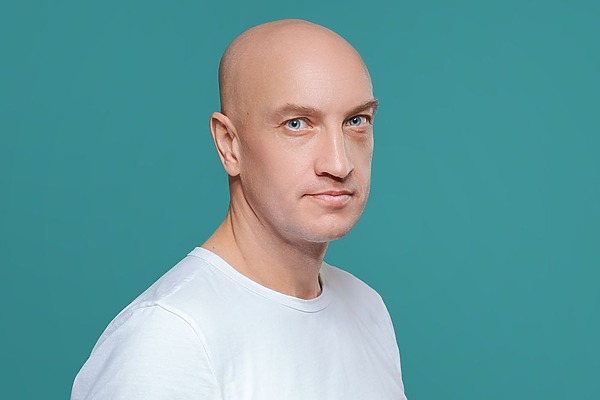 Alopecia Totalis Causes