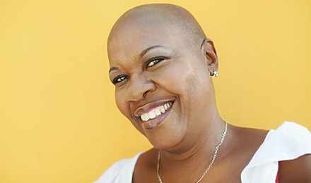 Types Of Alopecia