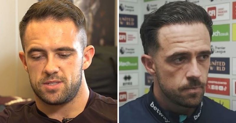 Danny Ings hair transplant