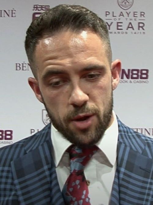 Danny Ings’ pre-hair transplant uneven hairline