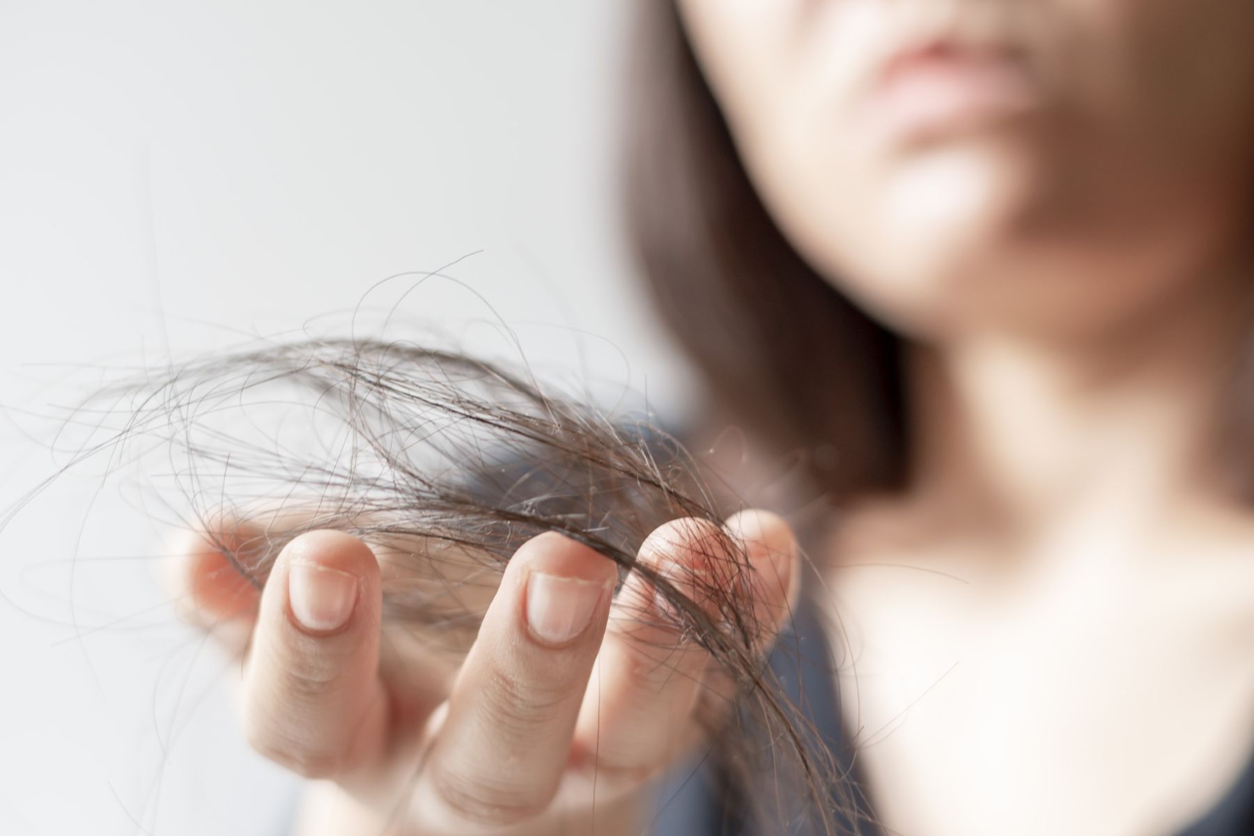 Does endometriosis cause hair loss?