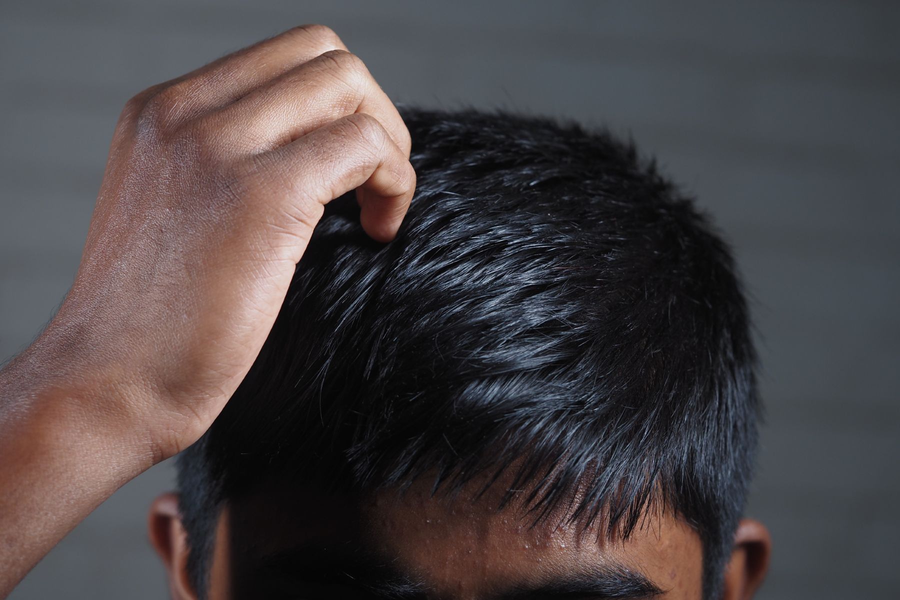 Idiopathic pruritus