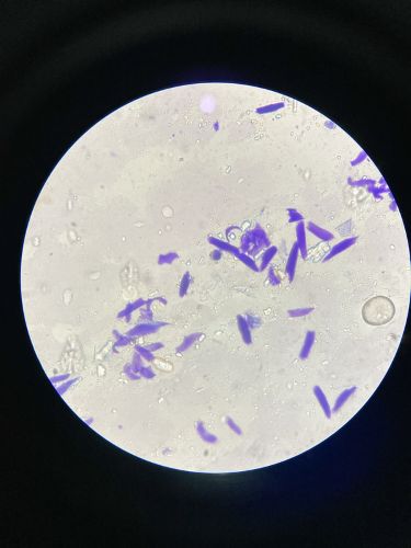 Malassezia