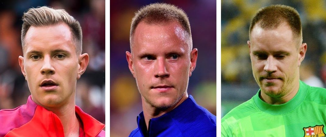 Marc-Andre Ter stegen’s worsening hair loss