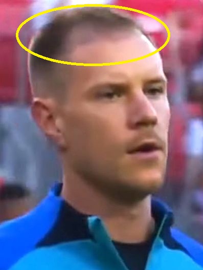 Ter Stegen's hair in 2022