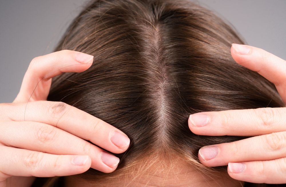 normal hair parting