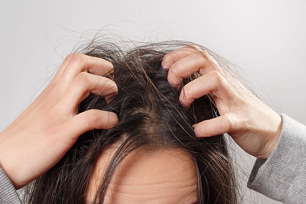 why does my scalp itch a day after washing