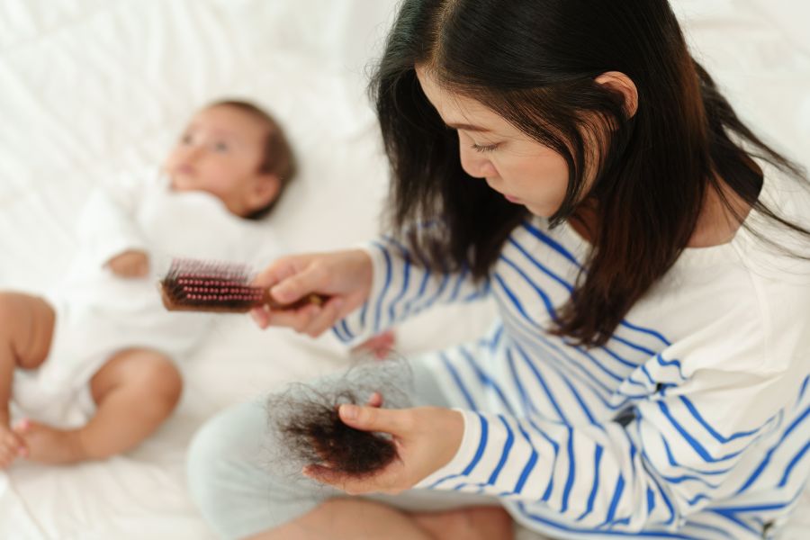 woman with postpartum hair loss