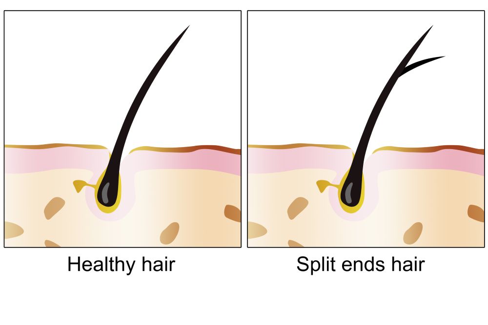 What does a healthy hair strand look like versus split ends?