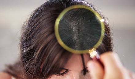 Can A Dry Scalp Cause Hair Loss