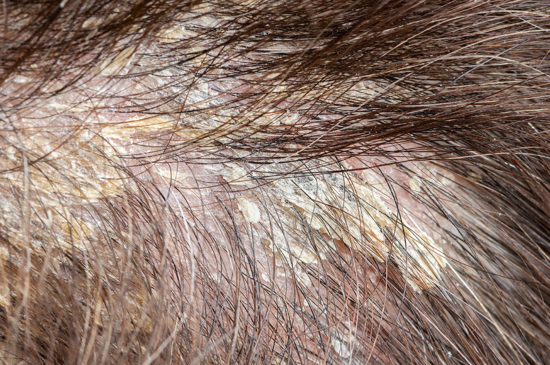 common scalp problems